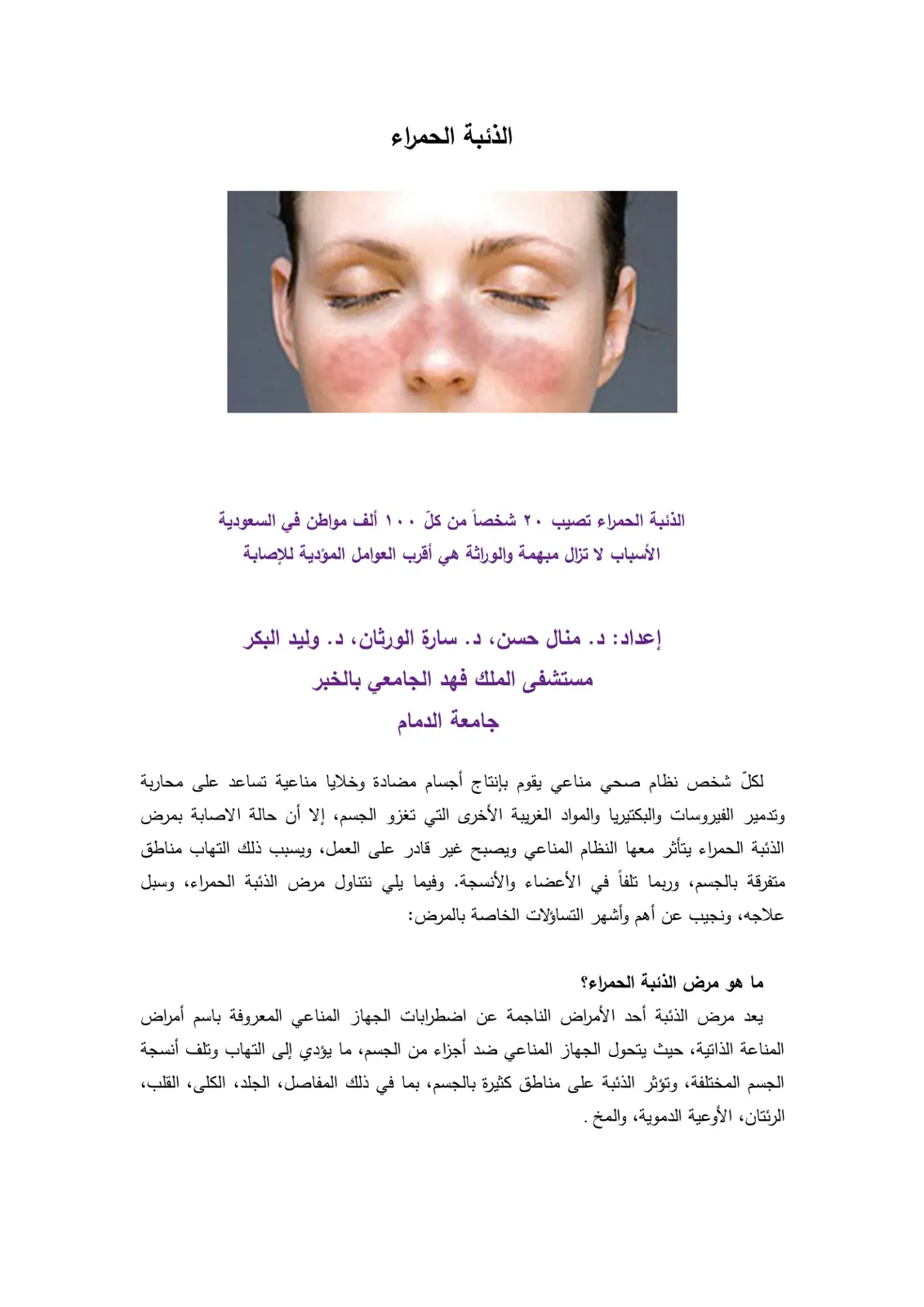 غلاف تقرير الذئبة الحمراء