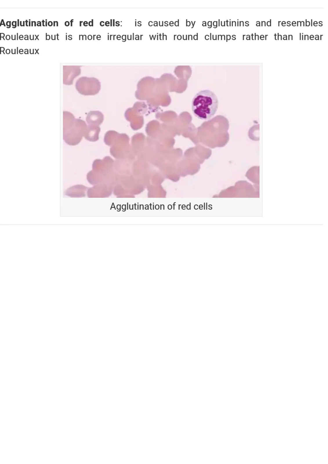 غلاف تقرير Agglutination of red cells