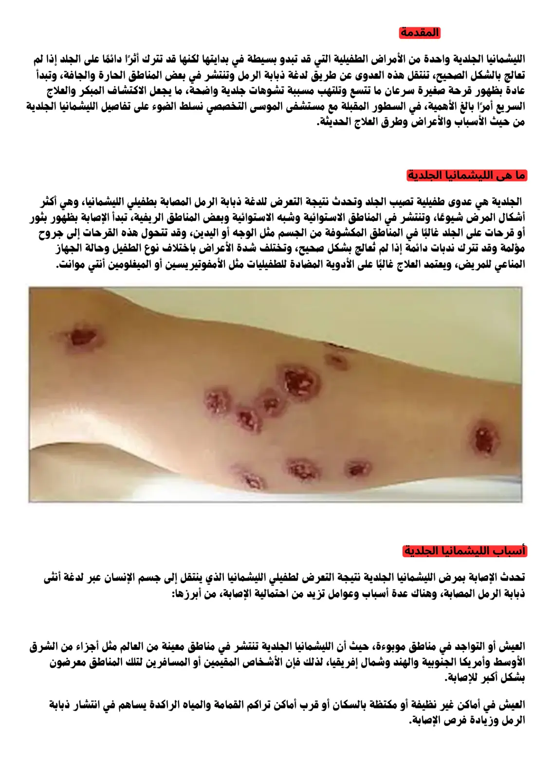 غلاف تقرير الليشمانيا الجلدية: الأسباب والأعراض وطرق العلاج الحديثة