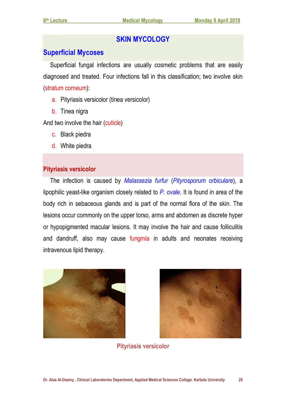 غلاف تقرير 6th Lecture - Medical Mycology: Superficial Mycoses