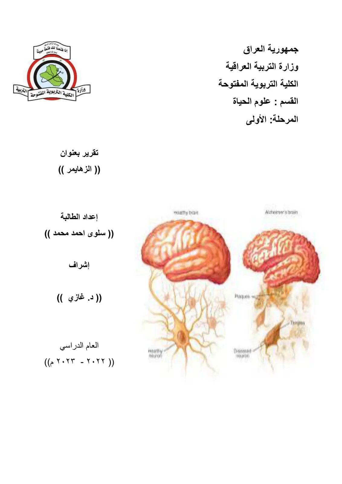 غلاف تقرير الزهايمر