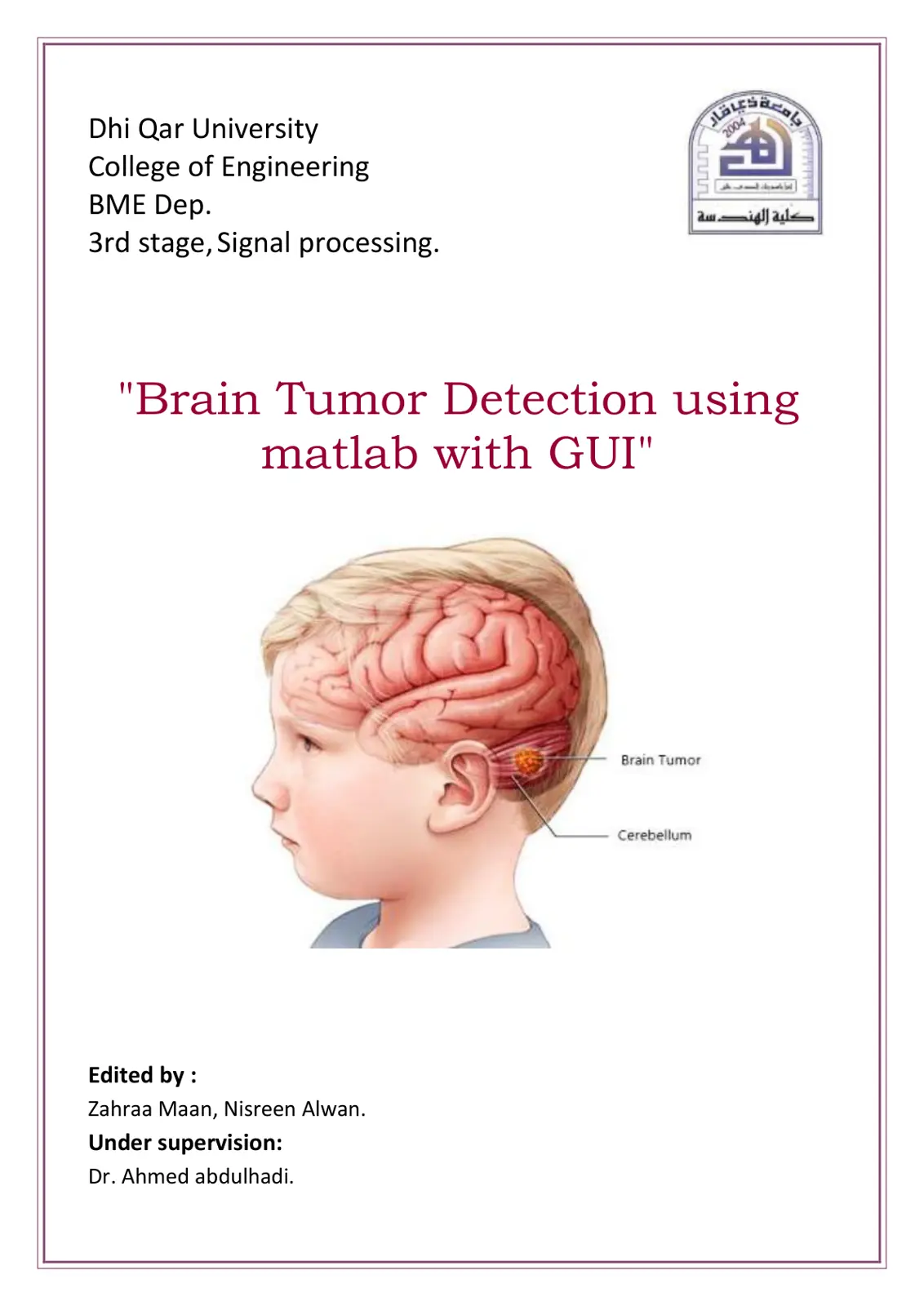 غلاف تقرير Brain Tumor Detection using matlab with GUI