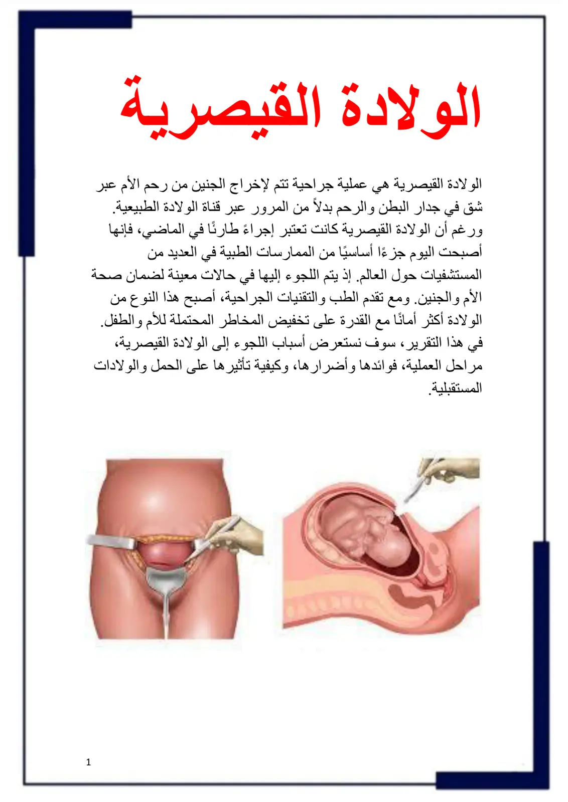 غلاف تقرير الولادة القيصرية