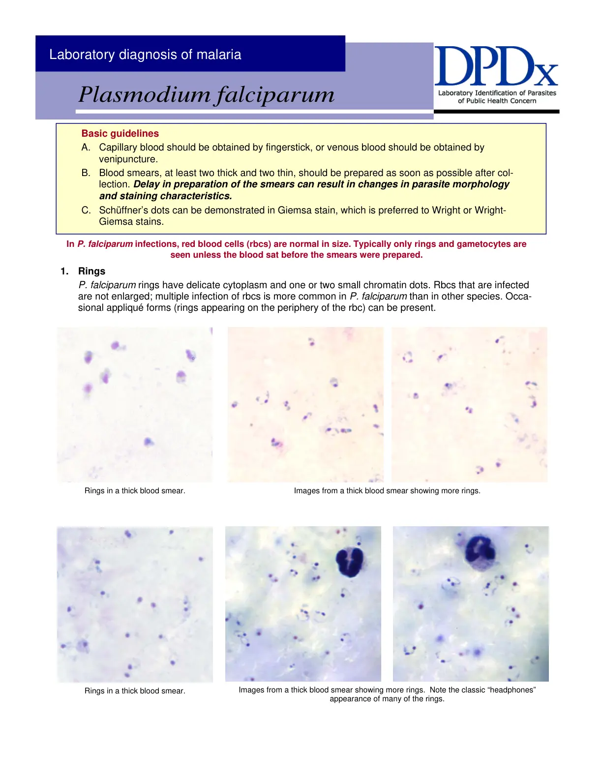 غلاف تقرير Laboratory diagnosis of malaria Plasmodium falciparum