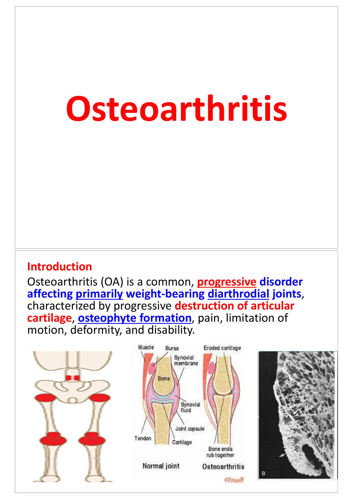 غلاف تقرير Osteoarthritis