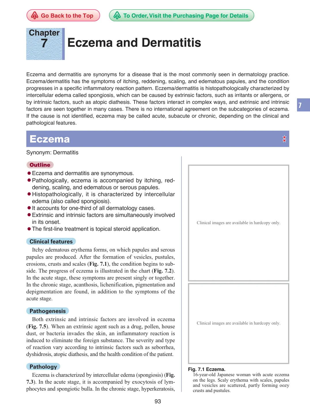 غلاف تقرير Eczema and Dermatitis