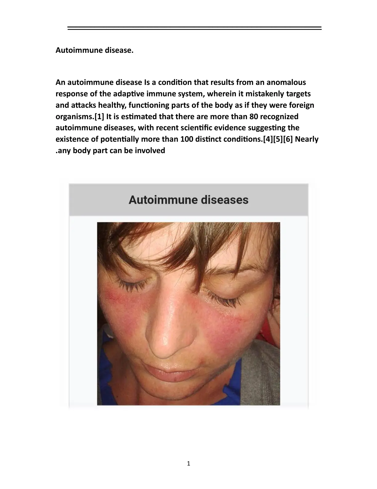 غلاف تقرير Autoimmune Disease