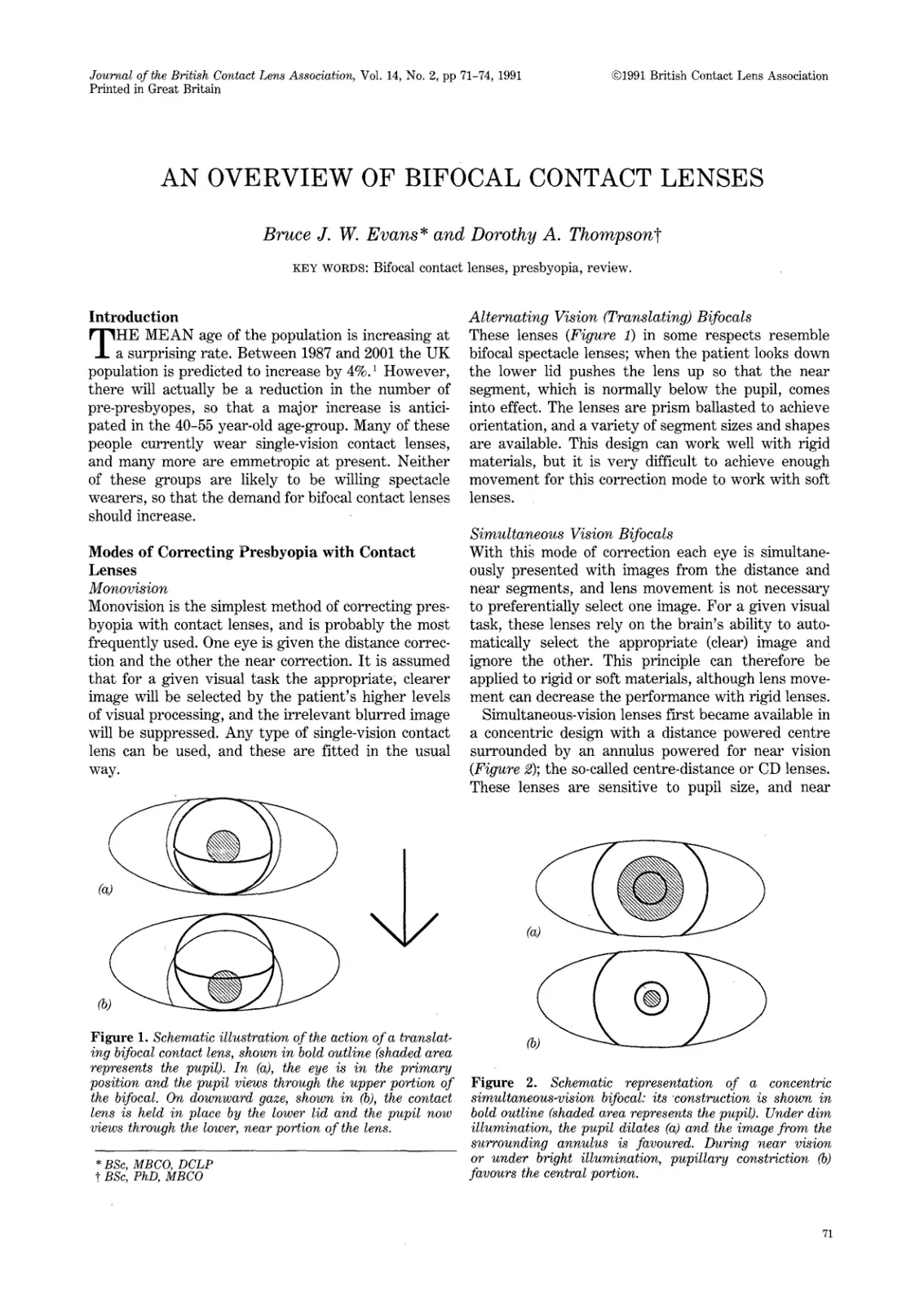 غلاف تقرير AN OVERVIEW OF BIFOCAL CONTACT LENSES
