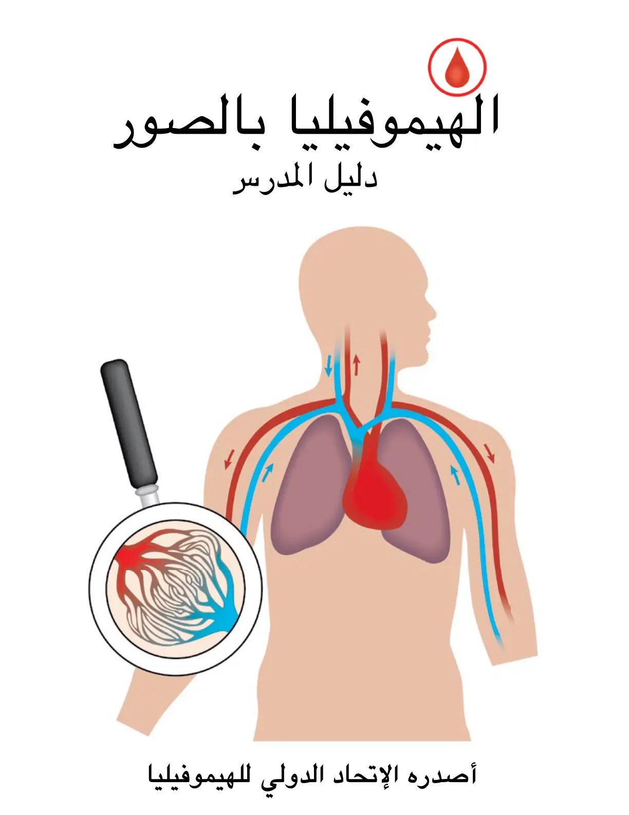 غلاف تقرير الهيموفيليا بالصور: دليل المدرس