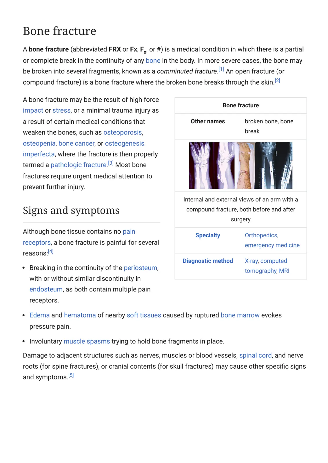 غلاف تقرير Bone fracture