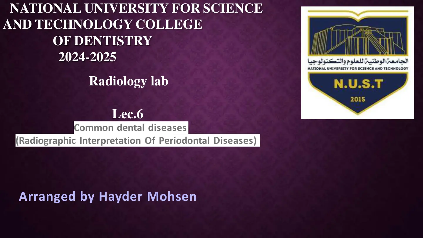 غلاف تقرير Common dental diseases (Radiographic Interpretation Of Periodontal Diseases)