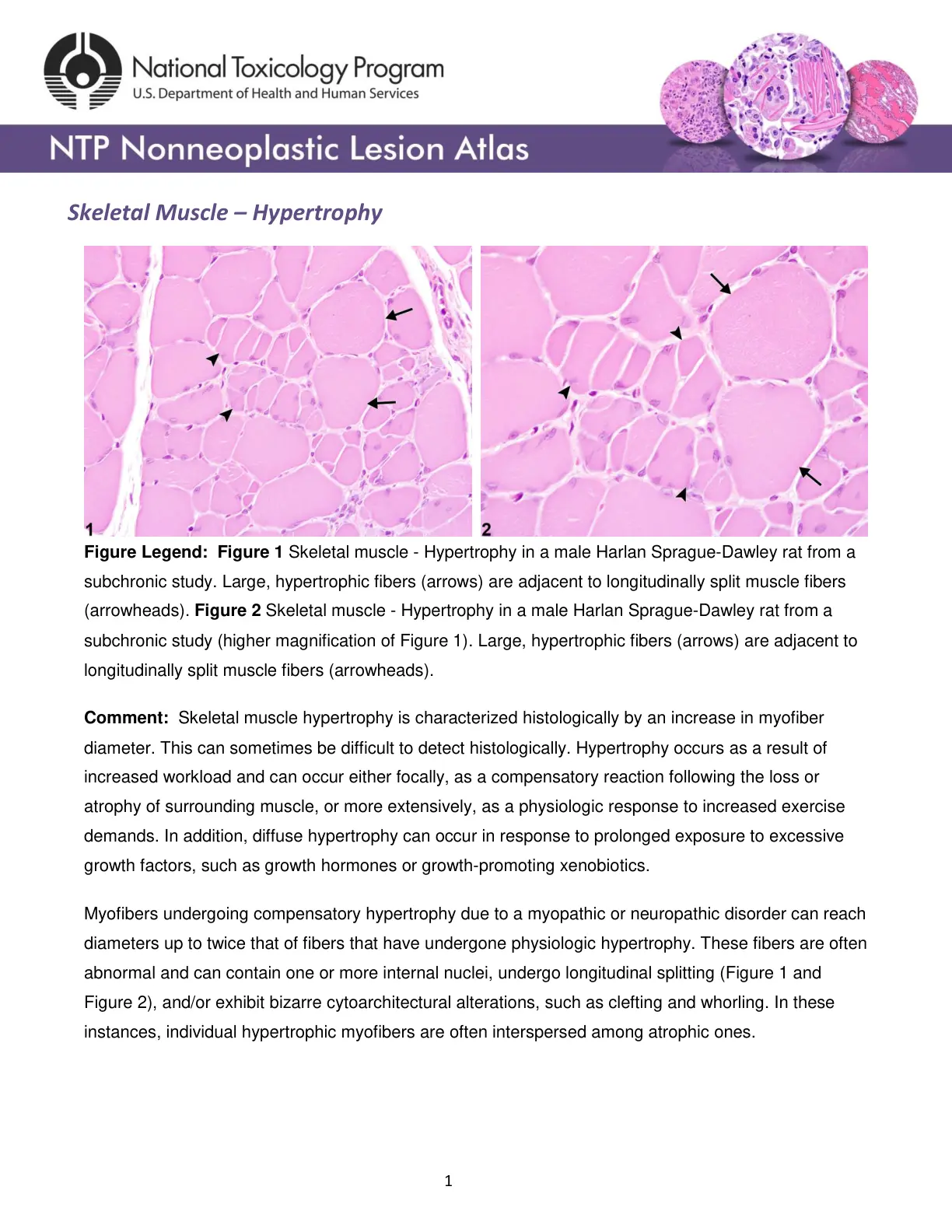 غلاف تقرير NTP Nonneoplastic Lesion Atlas