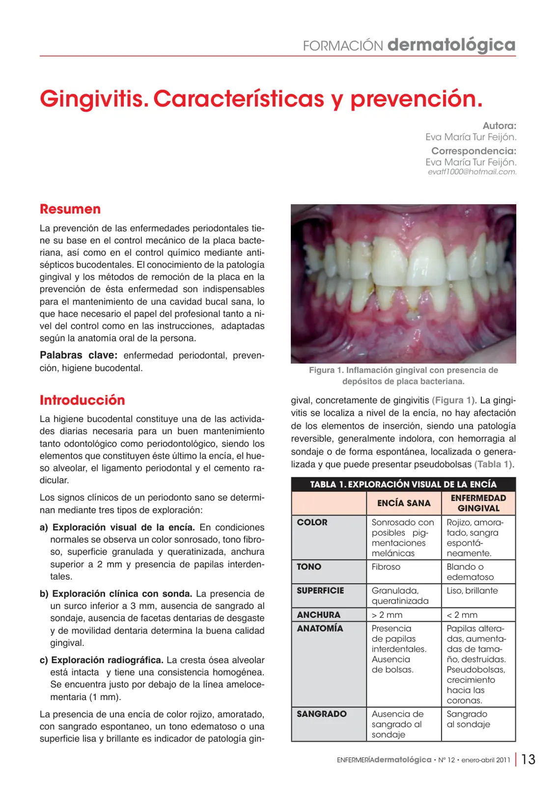 غلاف تقرير FORMACIÓN dermatológica Gingivitis. Características y prevención.