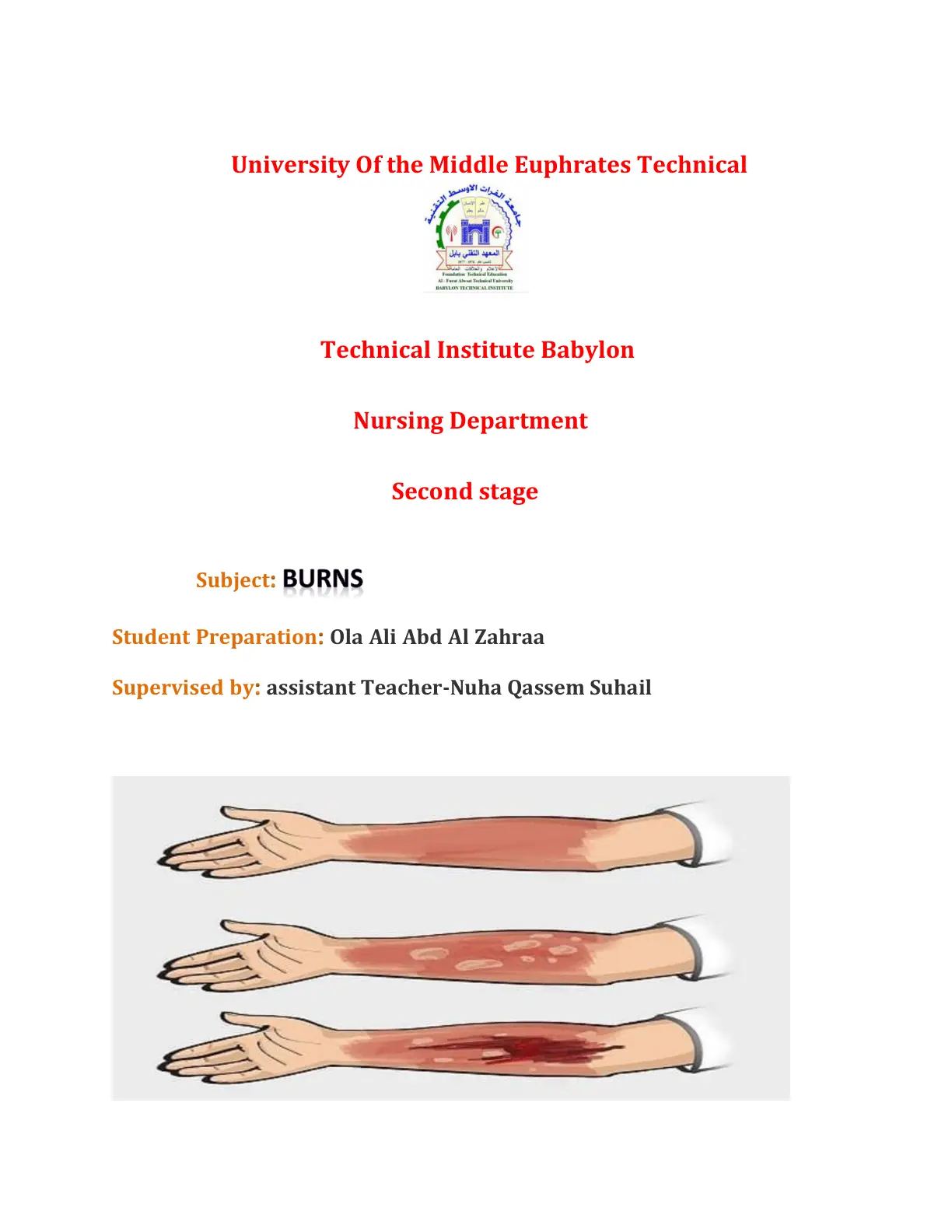غلاف تقرير BURNS