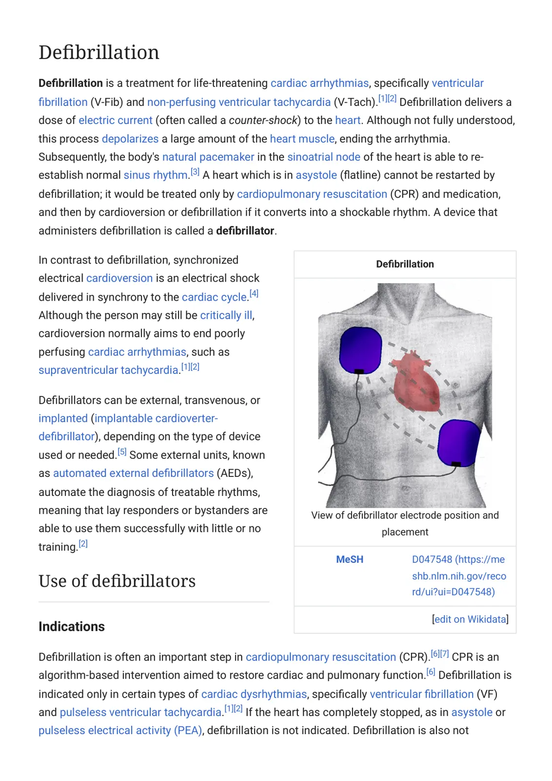 غلاف تقرير Defibrillation