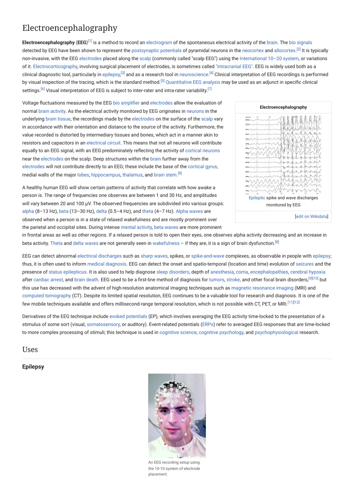 غلاف تقرير Electroencephalography