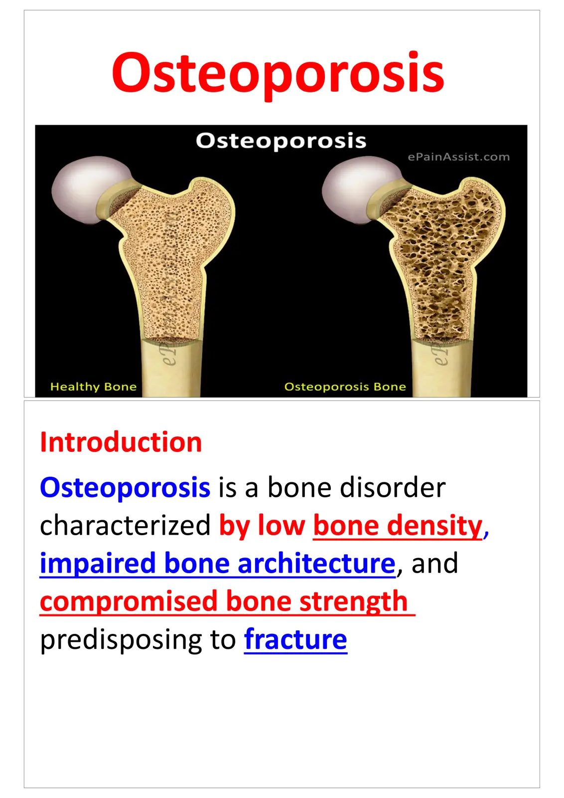 غلاف تقرير Osteoporosis