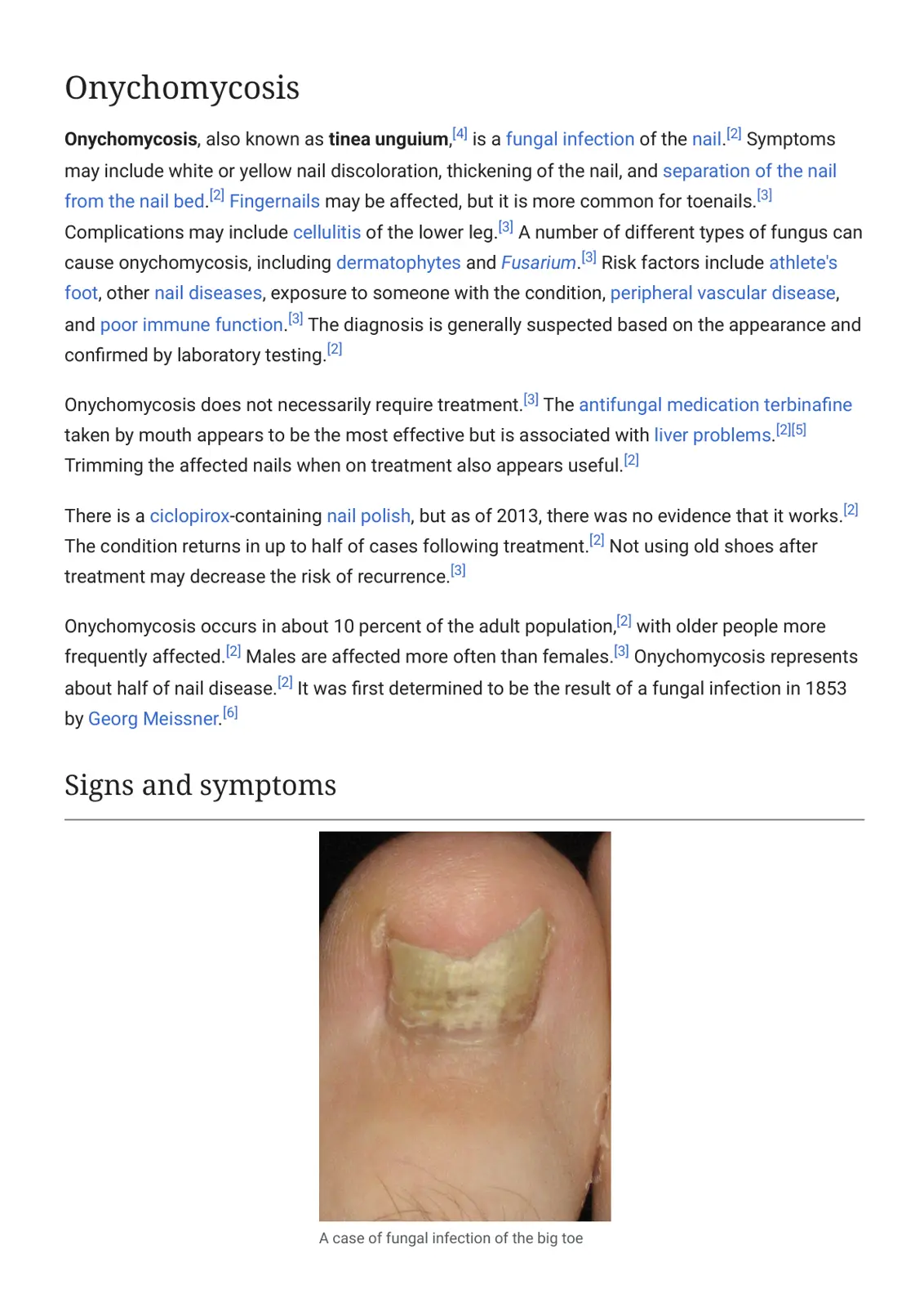 غلاف تقرير Onychomycosis