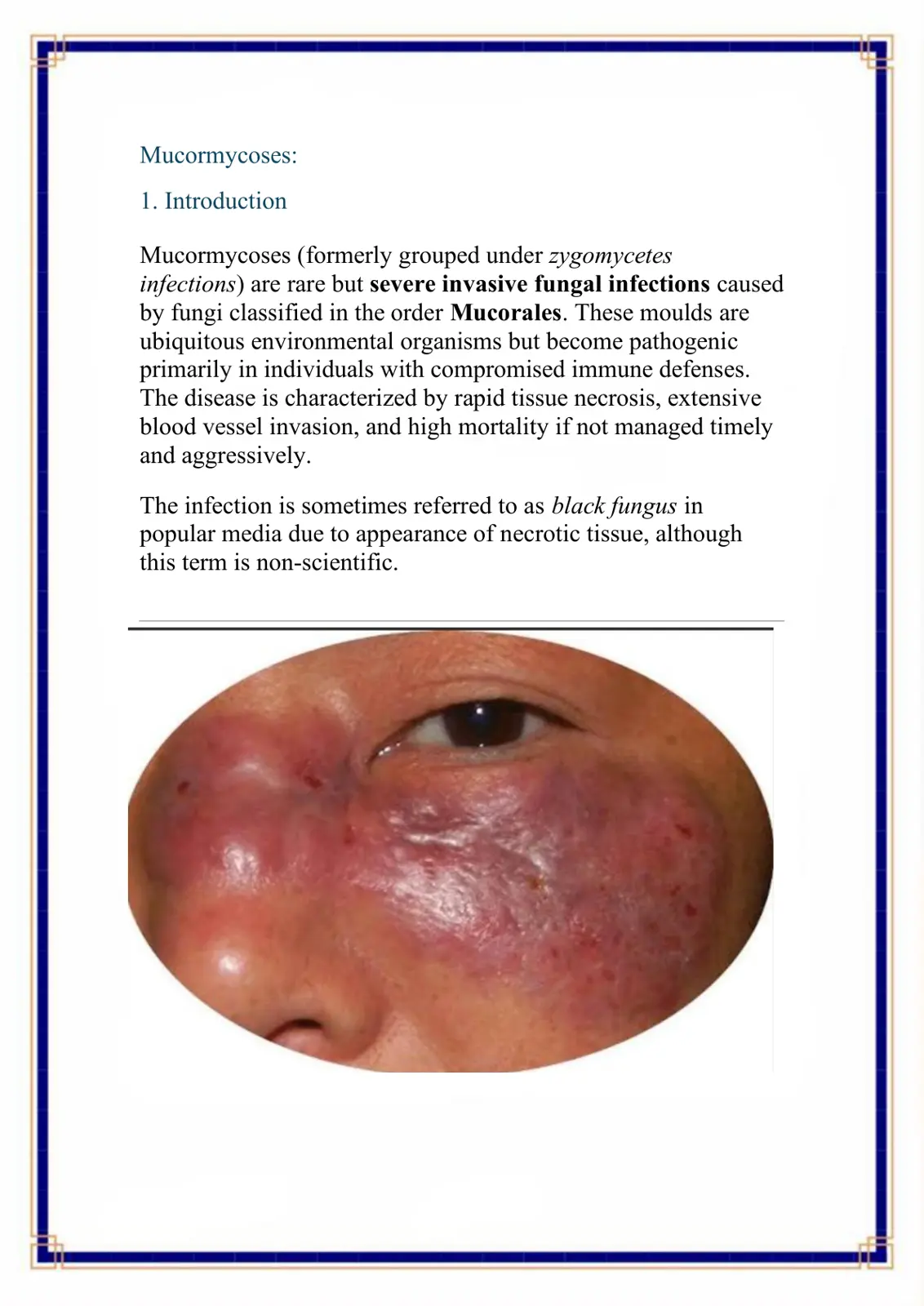 غلاف تقرير Mucormycoses