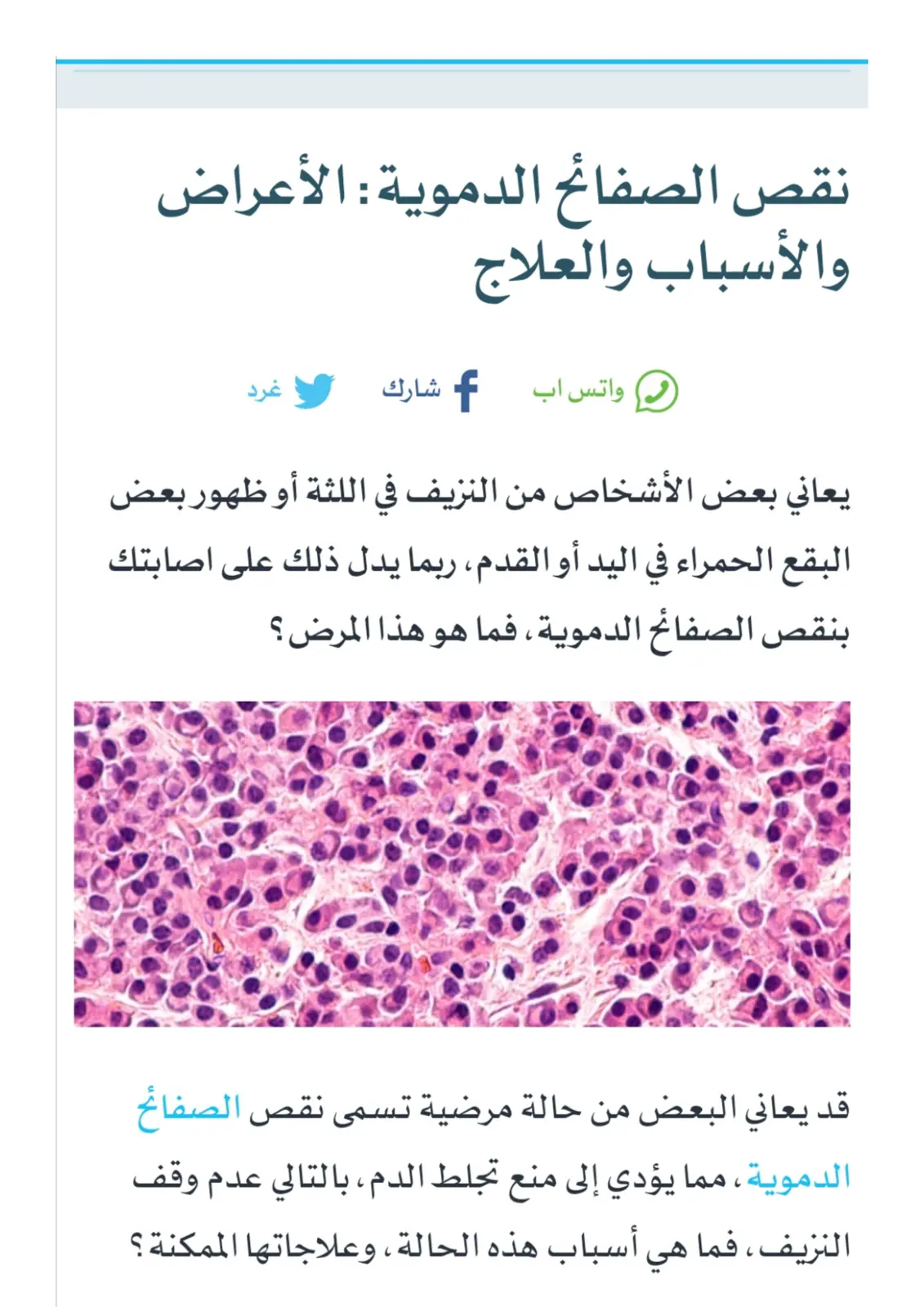 غلاف تقرير نقص الصفائح الدموية : الأعراض والأسباب والعلاج