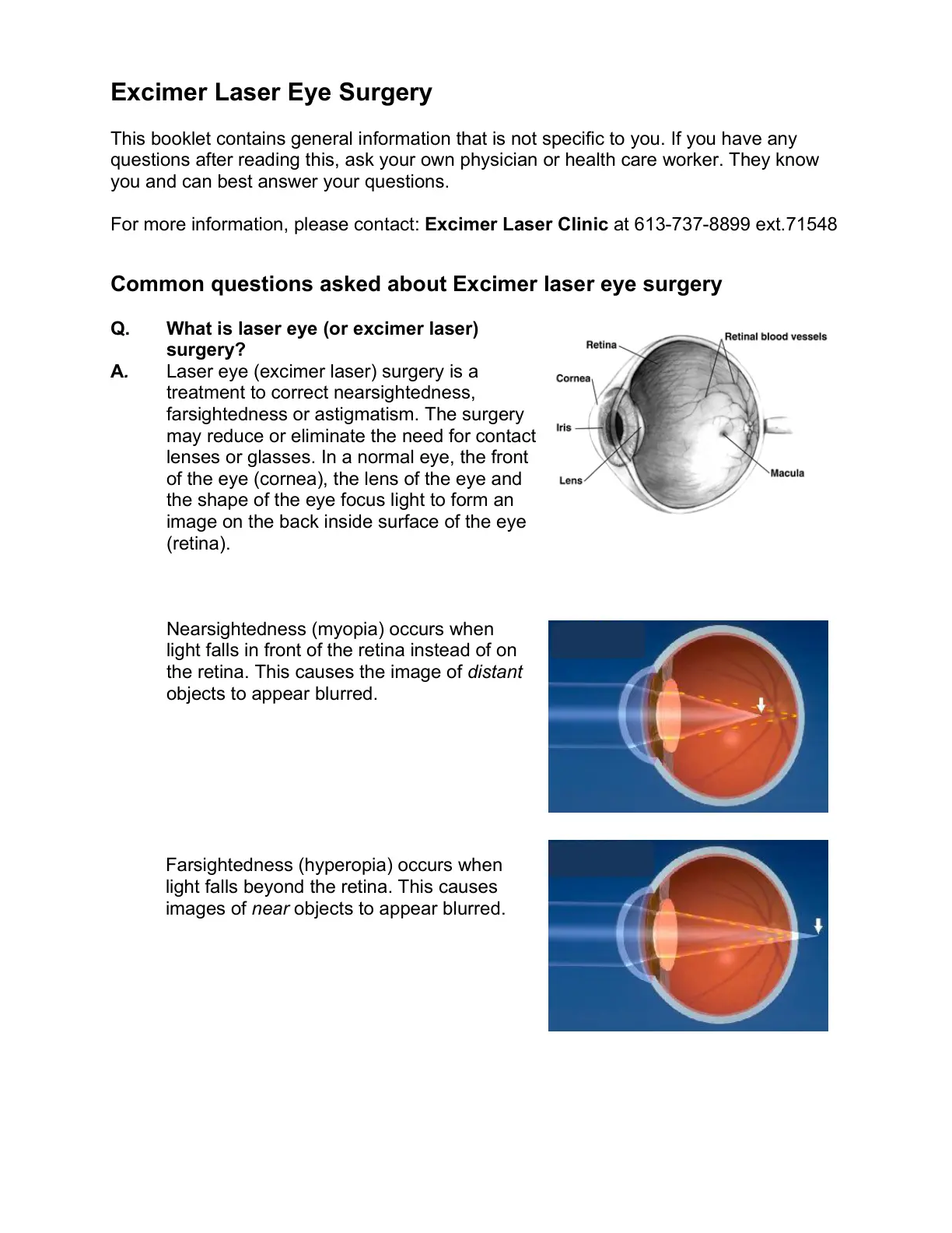 غلاف تقرير Excimer Laser Eye Surgery