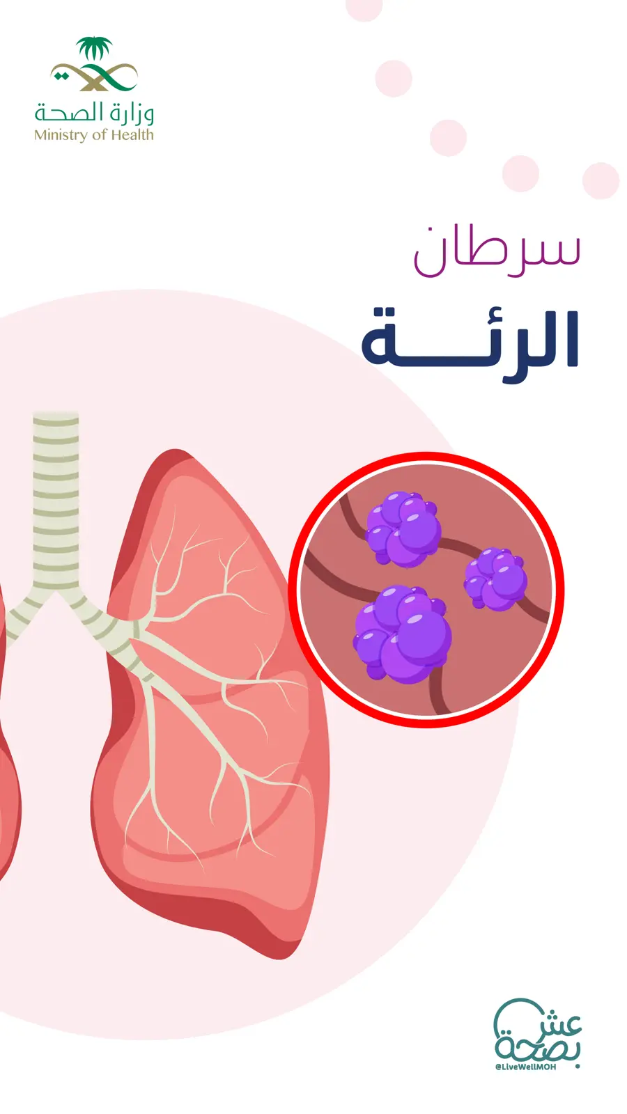 غلاف تقرير سرطان الرئة