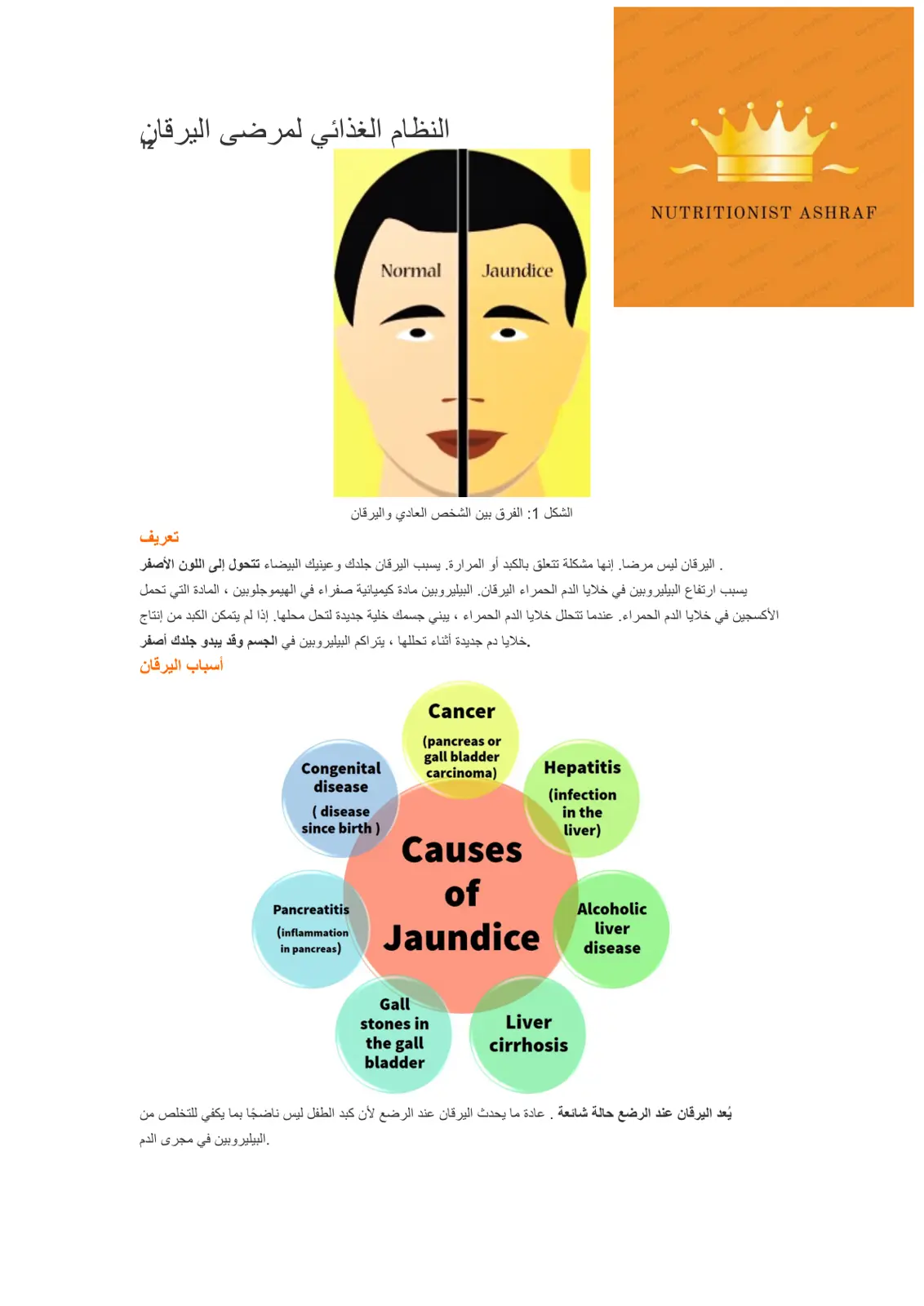 غلاف تقرير النظام الغذائي لمرضى اليرقان