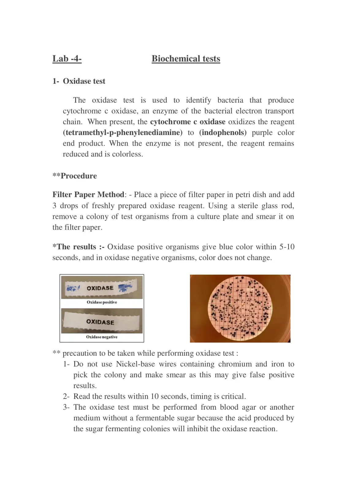 غلاف تقرير Oxidase test: Biochemical tests and Procedure