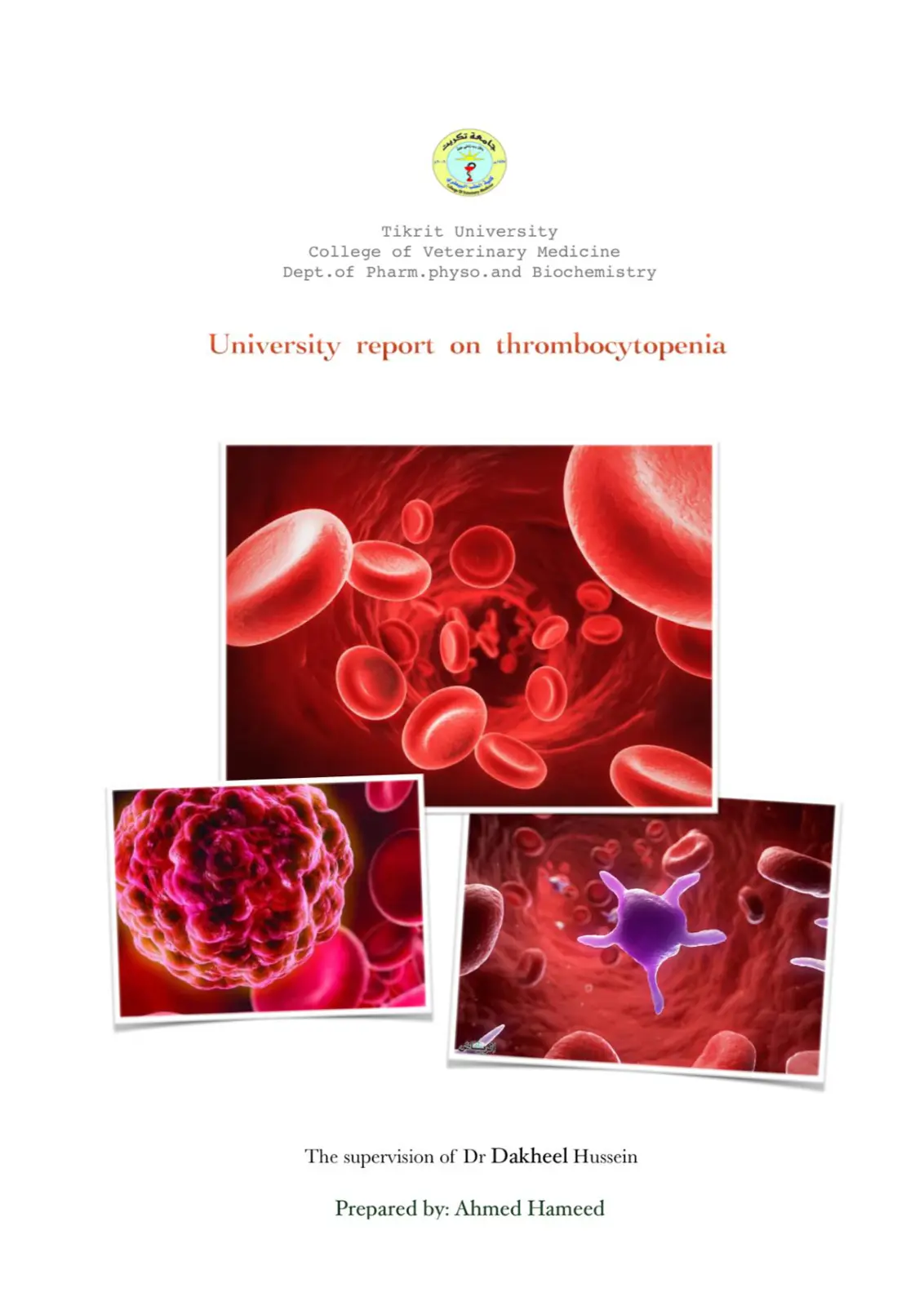 غلاف تقرير University report on thrombocytopenia
