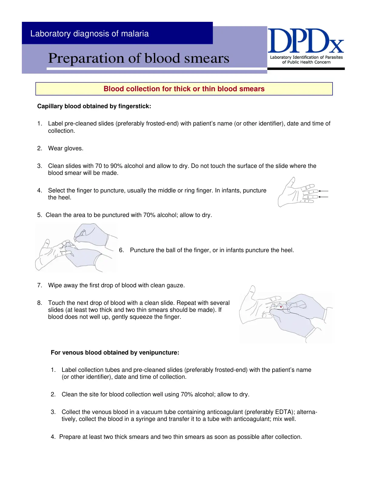 غلاف تقرير Laboratory diagnosis of malaria - Blood Collection
