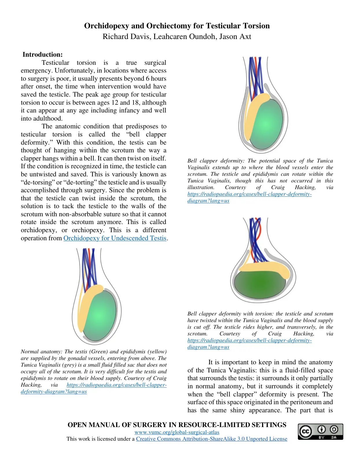 غلاف تقرير Orchidopexy and Orchiectomy for Testicular Torsion