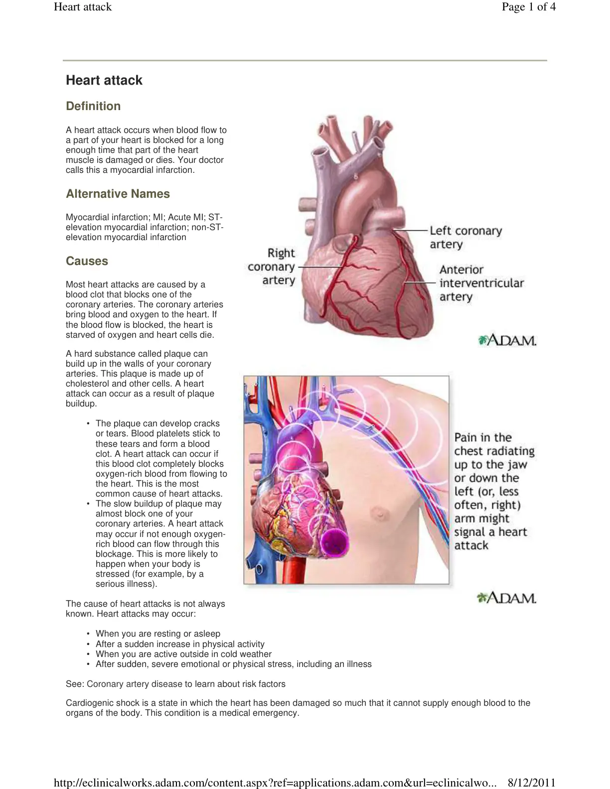 غلاف تقرير Heart attack