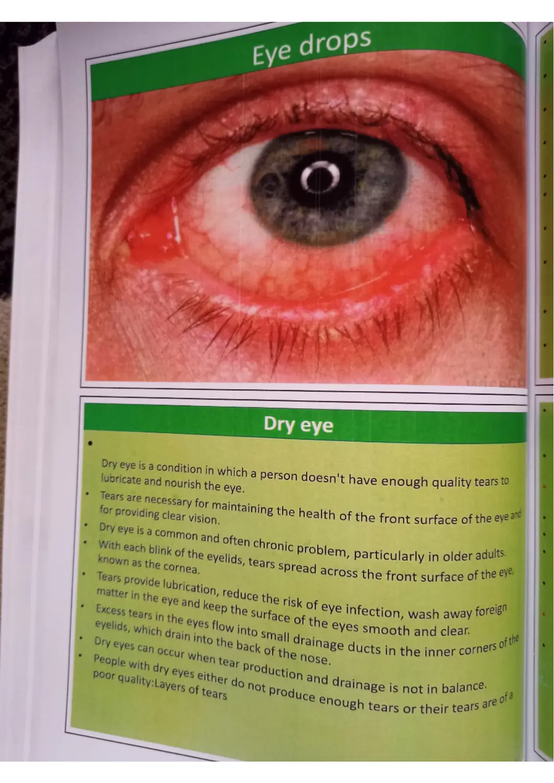 غلاف تقرير Dry eye