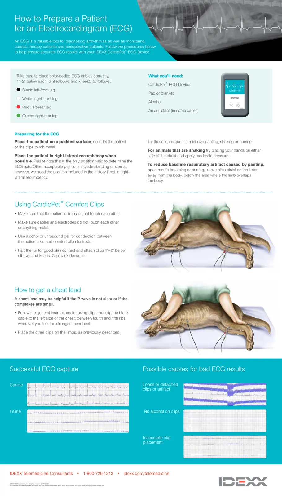 غلاف تقرير How to Prepare a Patient for an Electrocardiogram (ECG)