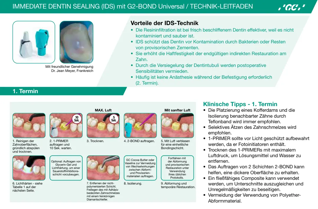 غلاف تقرير Immediate Dentin Sealing (IDS) mit G2-BOND Universal / Technik-Leitfaden