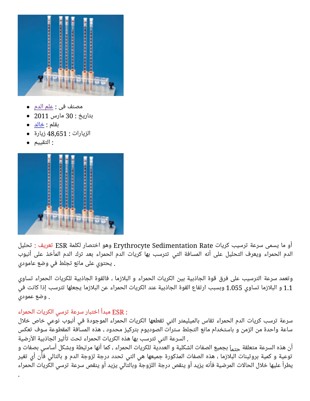 غلاف تقرير تحليل Erythrocyte Sedimentation Rate