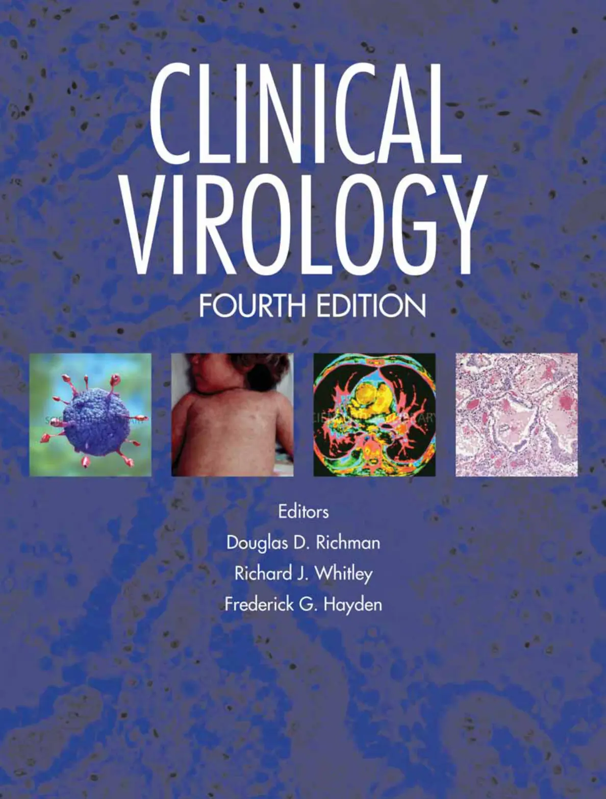 غلاف تقرير CLINICAL VIROLOGY