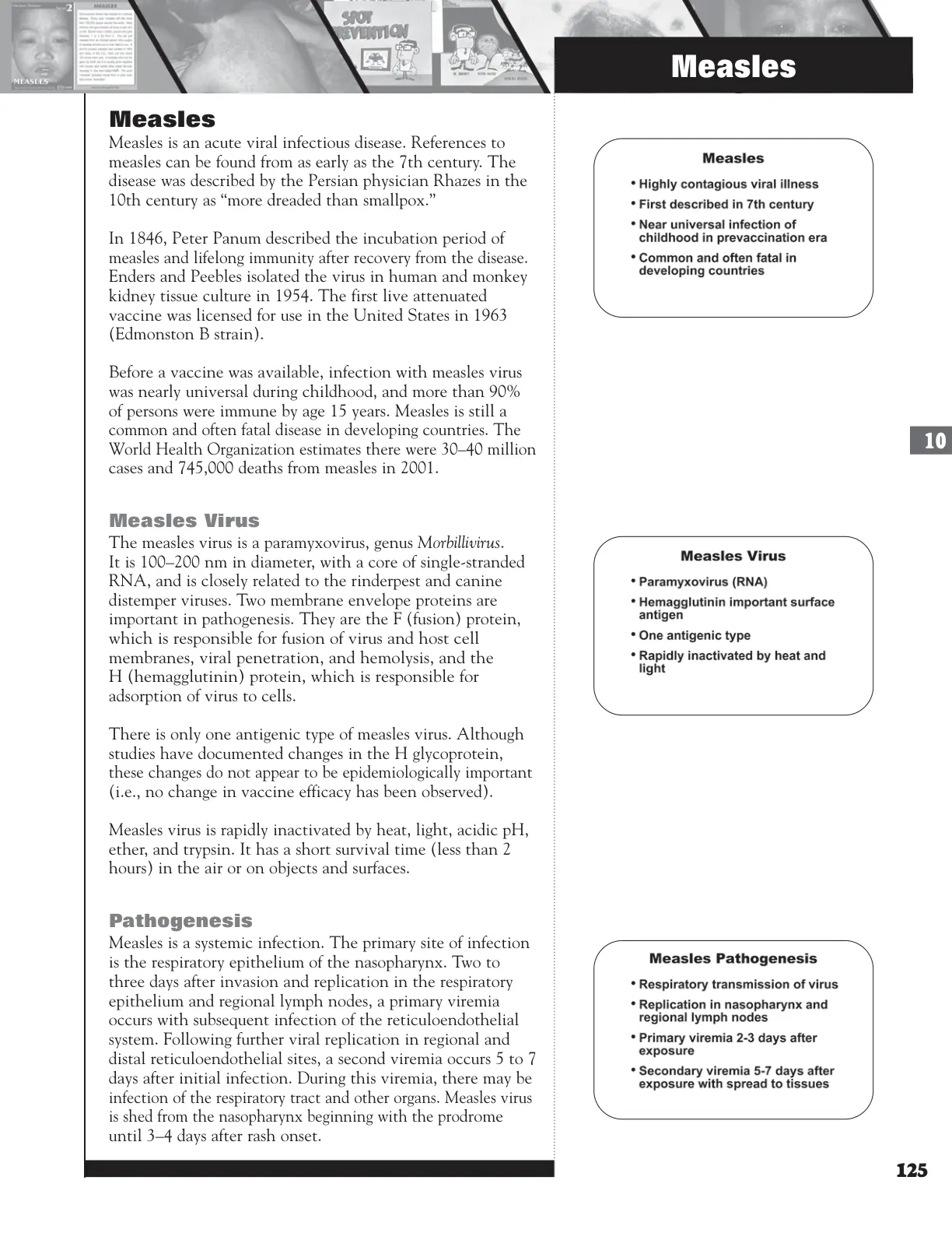 غلاف تقرير Measles: History and Prevention