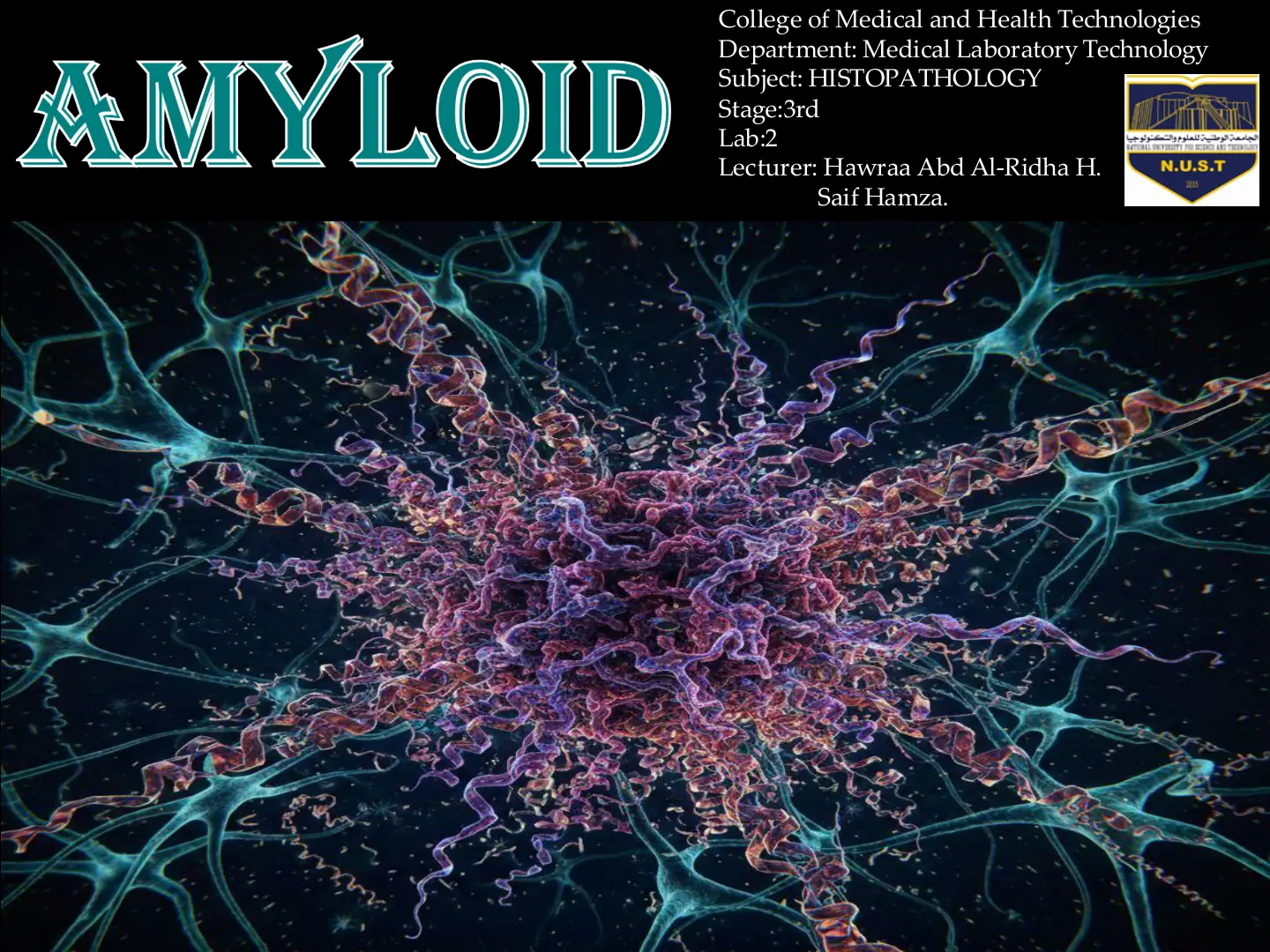غلاف تقرير Amyloid - HISTOPATHOLOGY