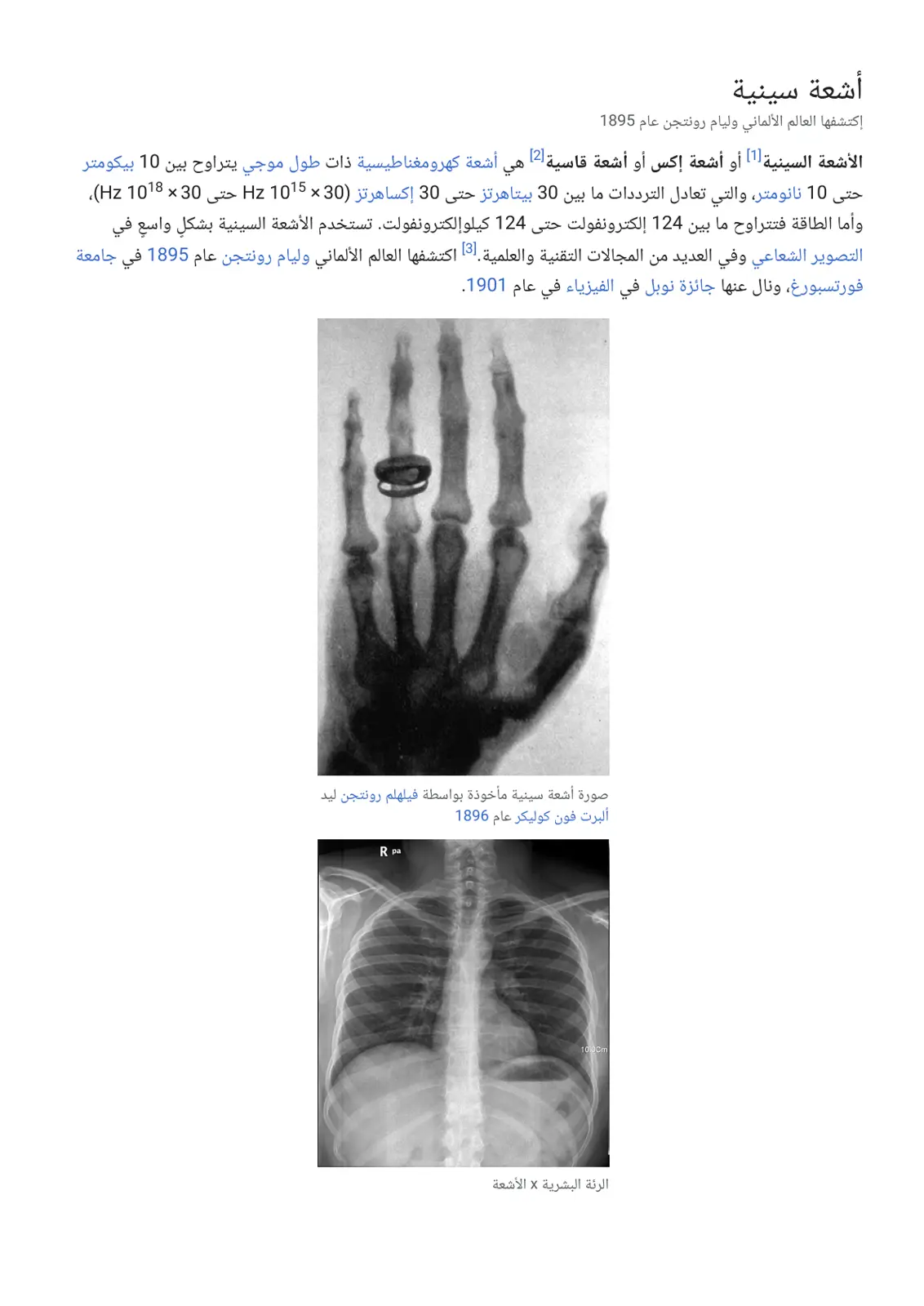 غلاف تقرير الأشعة السينية (أشعة إكس)